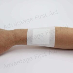 Adhesive Wound Dressings